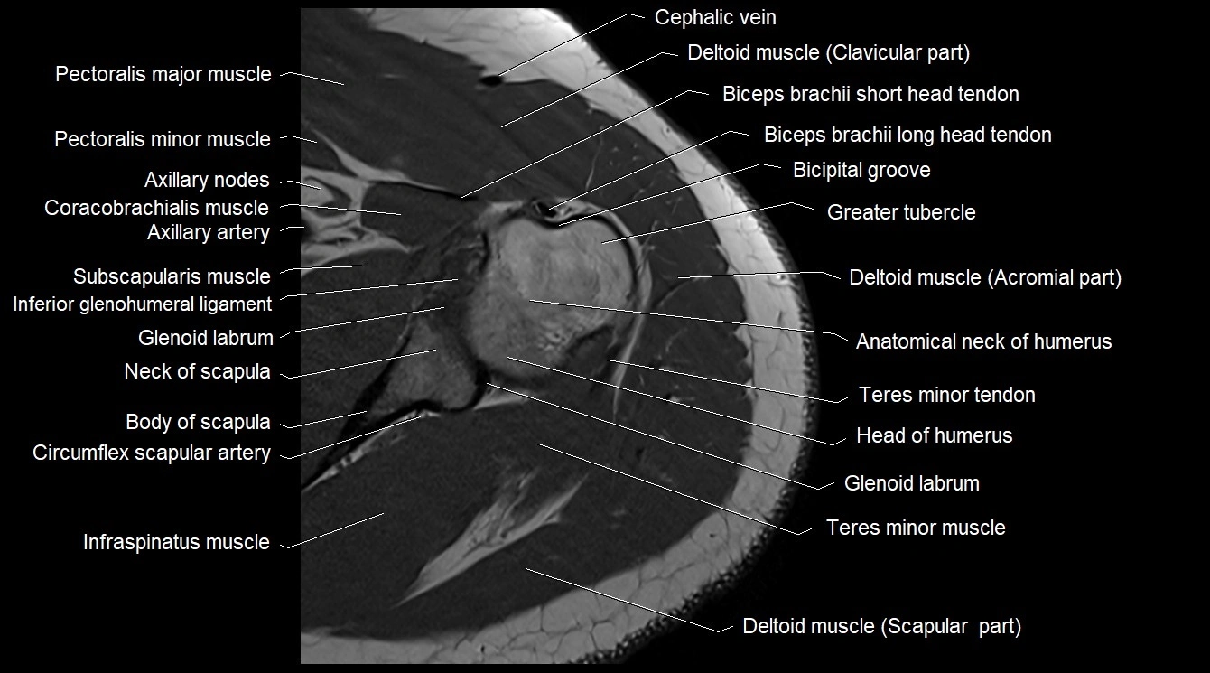 Upper arm( humerus) cross section anatomy MRI 3T axial image 13.webp